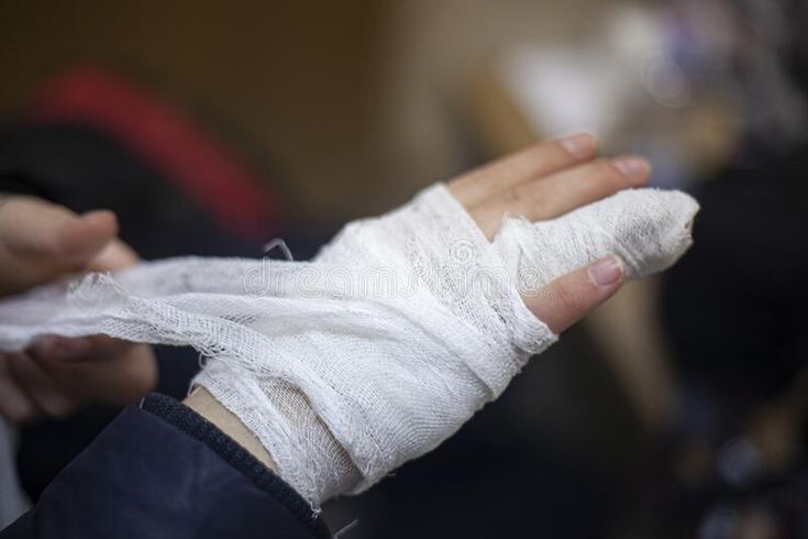 What is a Bandaged Hand at Home?