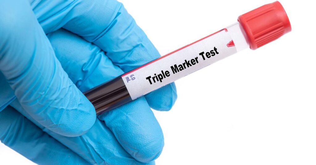 Triple Marker Test: A More Accurate Way To Detect Down Syndrome Pregnancies