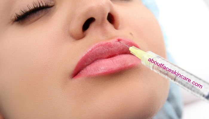 How to Take Care of Yourself After Having a Lip Filler Treatment